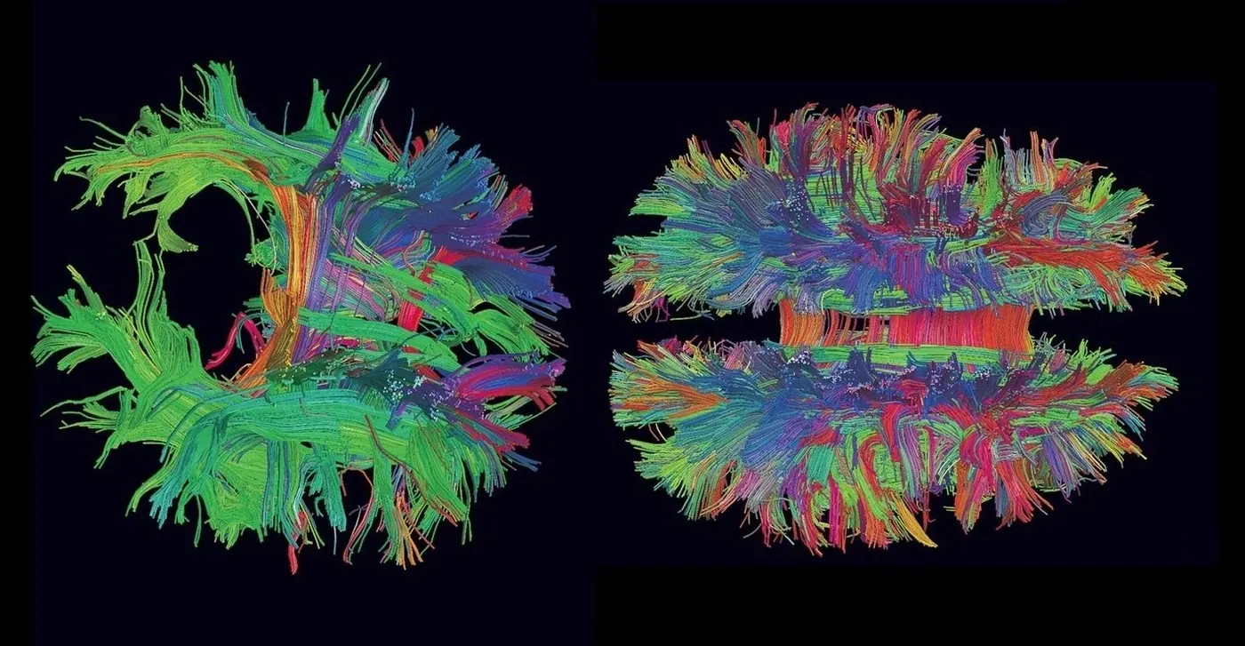 Colourful tractography renderings of white matter pathways in the brain